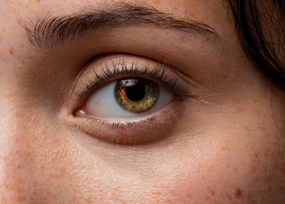 7 Infeksi Menular IMS yang Bisa Menyerang Mata, Waspada Gejalanya!