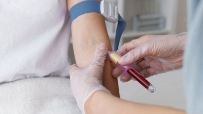 Hemofilia: Memahami Gangguan Pembekuan Darah di Indonesia