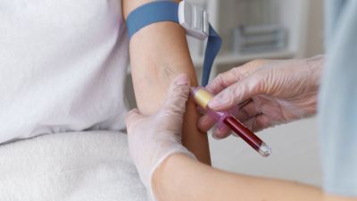 Memahami Sepsis: Ancaman Serius yang Perlu Diwaspadai