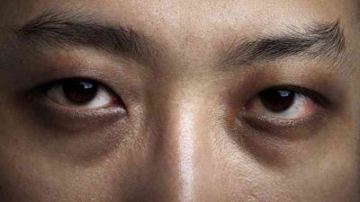 Cara Alami Atasi Mata Panda: Metode Efektif dan Mudah