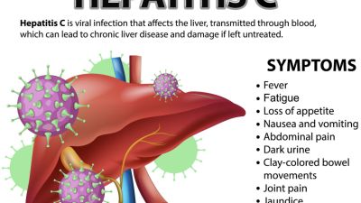 Hepatitis C: Pentingnya Penyuluhan dan Penanganan di Indonesia