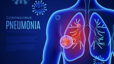 Pneumonia: Apa yang Perlu Diketahui dan Cara Mencegahnya