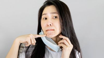 Jerawat Akibat Penggunaan Masker: Penyebab dan Solusi