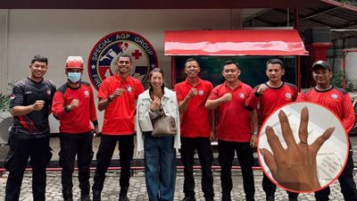 Aduh! Jennifer Bachdim Harus Relakan Cincin Nikahnya Demi Selamatkan Jari