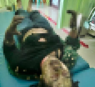 Dipicu Cemburu Buta, Suami di Sangatta Selatan Diduga Bakar Istri dan Anak