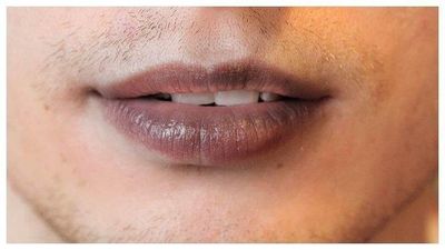 7 Bahan Alami untuk Hilangkan Bibir Hitam, Wajib Tau!
