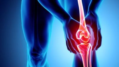 Memahami Osteoarthritis Lutut: Gejala, Penanganan, dan Kebutuhan Operasi