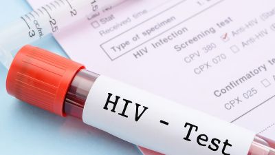Kesembuhan Menakjubkan: Pria Berusia 60 Tahun di Berlin Sembuh dari HIV