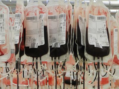 Golongan Darah yang Lebih Berisiko Terserang Stroke Dini