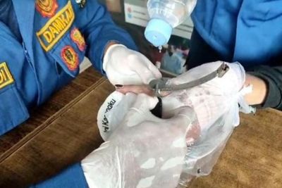 Evakuasi Cincin Titanium di Jari Warga Berlangsung Aman oleh Damkartan Kota Jambi