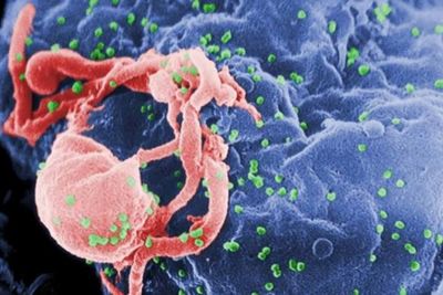 Dinkes Kota Jambi Temukan 167 Kasus Baru HIV Sepanjang Tahun 2025