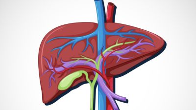Risiko Kesehatan Liver Akibat Konsumsi Makanan Berlemak