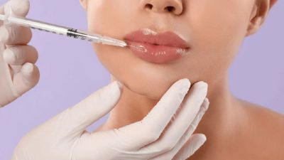 Filler Bibir: Manfaat, Prosedur, Biaya, dan Risiko yang Perlu Diketahui