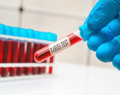 Gigitan Hewan Bisa Berujung Maut, Seberapa Bahaya Rabies Sebenarnya?