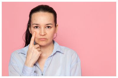 7 Cara Menghilangkan Kutil di Wajah yang Cepat dan Mudah, Bye Insecure!