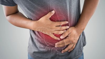 Peningkatan Kasus Kanker Usus Besar di Kalangan Muda: Apa yang Harus Diketahui?