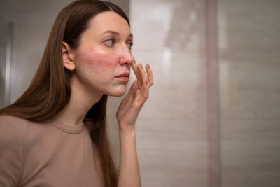 Jangan Salah Pilih, Ini Kandungan Skincare yang Aman untuk Kulit Breakout