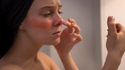 Panduan Memilih Serum yang Sesuai untuk Kulit Sensitif