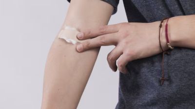 Tantangan Penyembuhan Luka pada Penderita Diabetes