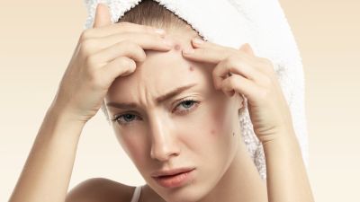 Cara Efektif Mengatasi Bruntusan di Dahi Secara Praktis