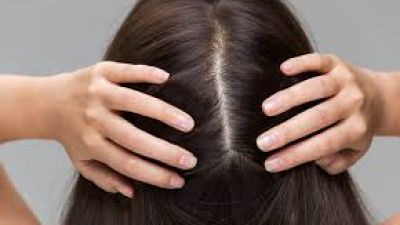 Tips Menjaga Kesehatan Rambut di Tengah Perubahan Gaya Hidup
