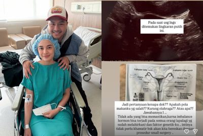 Alami Pendarahan hingga Jalani Empat Prosedur Operasi Sekaligus, Chelsea Olivia Sakit Apa?