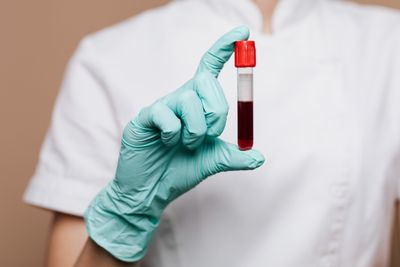 Apa Itu Golden Blood? Kenali Golongan Darah Super Langka yang Dijuluki Emas