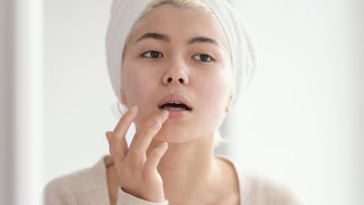 Tips Alami Mengatasi Bibir Kering yang Efektif
