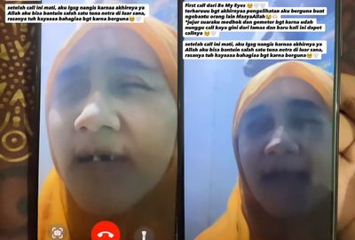 Bantu Tunanetra Lewat Aplikasi Be My Eyes, Ternyata Penglihatan Kita Bisa Berguna