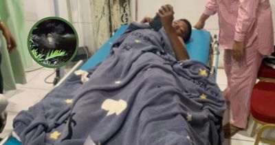 Nekat Nyebur demi Layangan, Bocah SMP di Kutim Lolos dari Maut Usai Diterkam Buaya 5 Meter