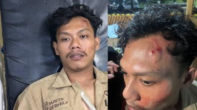 Menjadi Korban Pengeroyokan di Lingkungan Kampus UNIBA, Mahasiswa Tempuh Jalur Hukum