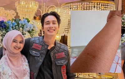 Viral! Selebgram Asal Pidie Aceh Uffridatun Mengaku Alami KDRT oleh Sang Suami
