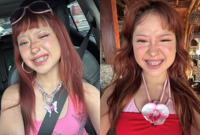Viral Tooth Gems ala Naykilla, Tren Y2K Ini Bikin Senyum Makin Berkilau