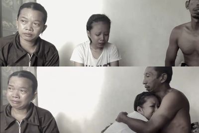 6 Tahun Berjuang Lawan Penyakit, Wanita Ini Nangis saat Ungkap Mata Kirinya Buta ke Orang Tua