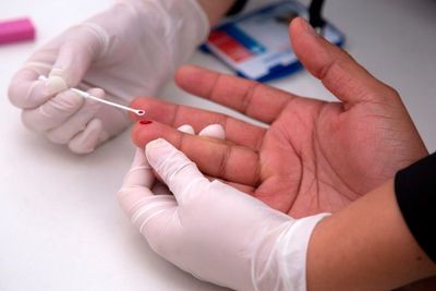 Beredar Konspirasi Di Rusia Bahwa HIV-AIDS Tidak Nyata