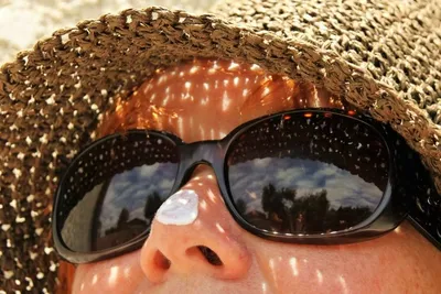 Sunscreen Memicu Jerawat? Ini Pemilihan Sunscreen yang Tepat
