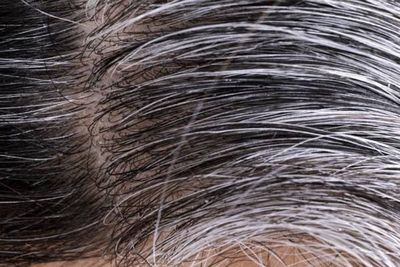 5 Makanan Kaya Melanin untuk Mencegah Rambut Beruban di Usia Muda