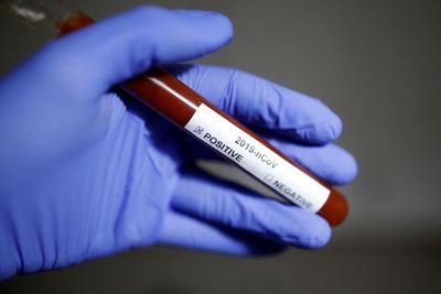 Ilmuwan Nilai Virus Korona Baru Harus Punya Nama Resmi