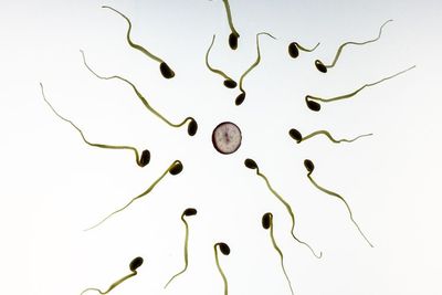 Apa Itu Spermatogenesis? Ini Proses Terbentuknya Sperma pada Pria