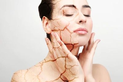 Kulit Kering vs Dehidrasi Ternyata Beda, Jangan Sampai Salah Skincare! Ini Cara Membedakannya