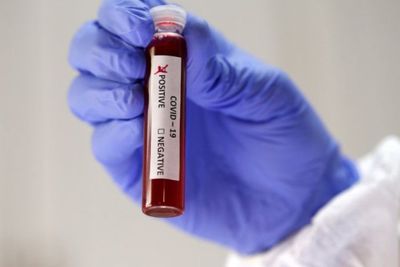 4 Klub La Liga Tolak Bantuan Kit Pengujian Virus Corona