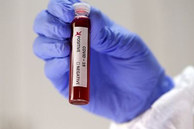 Rapid Test Massal, Dinkes DKI: 299 Orang Positif Corona