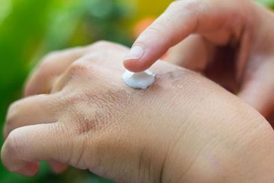 Mengenal RDEB, Penyakit Langka yang Menyiksa Penderitanya