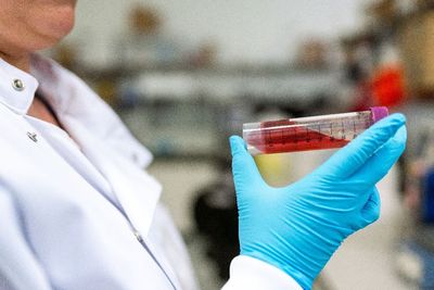 Rapid Test Positif Belum Tentu Terinfeksi Virus Corona, Benarkah?
