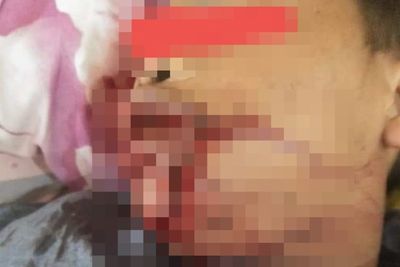 Ilham Diculik dan Dianiaya, Keluarga Minta Polsek Dolok Paluta Tangkap Pelaku