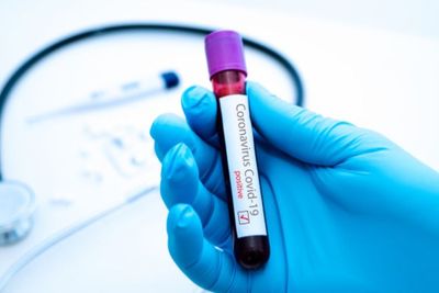Pemerintah Siapkan 1.500 Alat Rapid Test Virus Corona, Disebar ke Daerah Ini