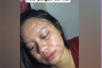 Seorang Wanita Curhat Ditinggal Gebetan Gegara si Cowok Jijik Lihat Wajahnya