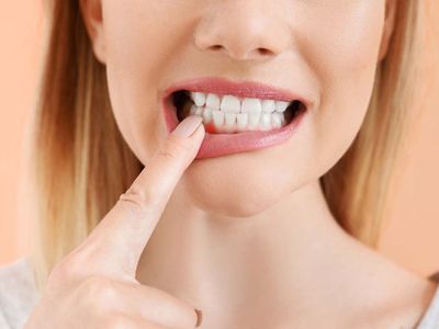 6 Cara Alami Mengobati Gusi Bengkak agar Cepat Kempes