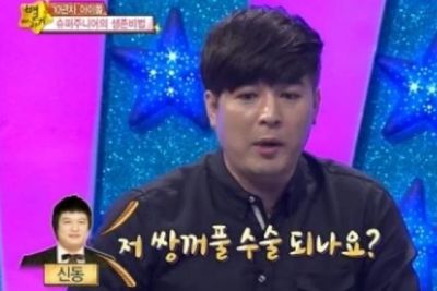 Dikabarkan Bunuh Diri, Shindong Super Junior Akui Pernah Lakukan Operasi Plastik