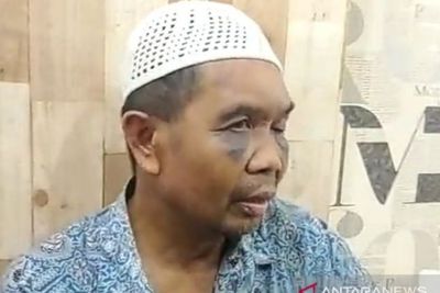 Komnas HAM Desak Polri Tindak Polisi Penyiksa Saksi di Sumut 